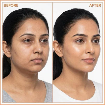 Lymphatic  Face Brush